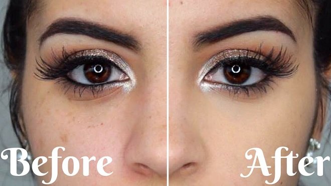 trước và sau khi dùng kem che khuyết điểm